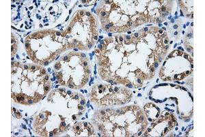 Immunohistochemical staining of paraffin-embedded liver tissue using anti-HDAC10mouse monoclonal antibody. (HDAC10 Antikörper)