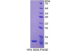 SDS-PAGE analysis of Rat IDO Protein. (IDO Protein)
