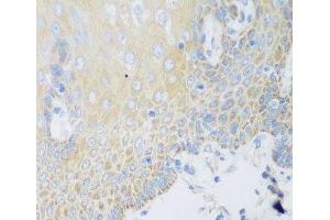 Immunohistochemistry of paraffin-embedded Human esophagus using DHODH Polyclonal Antibody at dilution of 1:100 (40x lens). (DHODH Antikörper)