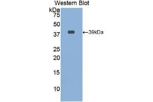 Western blot analysis of the recombinant protein. (Osteocalcin Antikörper  (AA 21-99))
