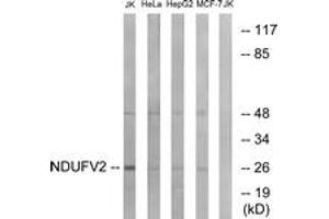 Western blot analysis of extracts from Jurkat/HeLa/HepG2/MCF-7 cells, using NDUFV2 Antibody. (NDUFV2 Antikörper  (AA 20-69))