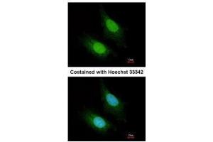 ICC/IF Image Immunofluorescence analysis of paraformaldehyde-fixed HeLa, using ZC3H12A, antibody at 1:200 dilution. (ZC3H12A Antikörper)