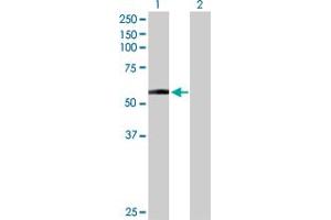Western Blot analysis of DDC expression in transfected 293T cell line by DDC MaxPab polyclonal antibody.