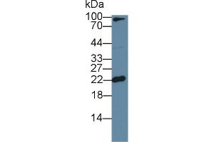 Western blot analysis of Mouse Cerebrum lysate, using Mouse FTL Antibody (1 µg/ml) and HRP-conjugated Goat Anti-Rabbit antibody ( (FTL Antikörper  (AA 5-183))
