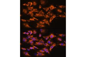 Immunofluorescence analysis of NIH/3T3 cells using  Rabbit pAb (ABIN3021619, ABIN3021620, ABIN3021621 and ABIN6215402) at dilution of 1:100. (Arrestin 3 Antikörper  (AA 300-400))