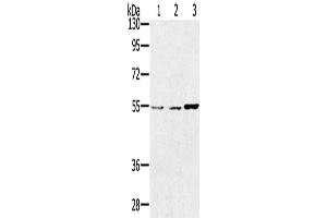 Western Blotting (WB) image for anti-Sestrin 2 (SESN2) antibody (ABIN2433787) (Sestrin 2 Antikörper)