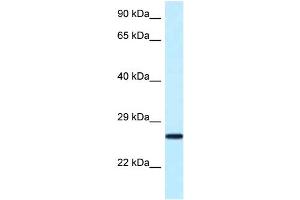 WB Suggested Anti-Nudt16 Antibody Titration: 1. (NUDT16 Antikörper  (N-Term))