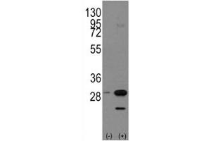 Western blot analysis of PHB antibody and 293 cell lysate either nontransfected (Lane 1) or transiently transfected with the PHB1 gene (2). (Prohibitin Antikörper  (AA 182-211))