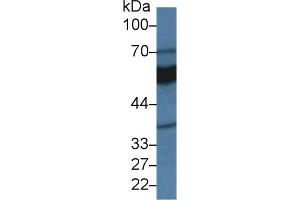 Detection of MAOA in Rat Kidney lysate using Polyclonal Antibody to Monoamine Oxidase A (MAOA) (Monoamine Oxidase A Antikörper  (AA 2-497))