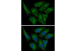 ICC/IF analysis of PAI1 in HeLa cells line, stained with DAPI (Blue) for nucleus staining and monoclonal anti-human PAI1 antibody (1:100) with goat anti-mouse IgG-Alexa fluor 488 conjugate (Green) (PAI1 Antikörper  (AA 24-402))