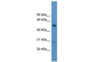 Image no. 1 for anti-Protein Phosphatase 2, Regulatory Subunit B, gamma (PPP2R2C) (AA 21-70) antibody (ABIN6746534)