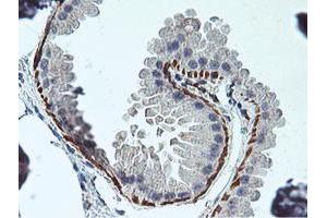 Immunohistochemical staining of paraffin-embedded Human breast tissue using anti-RFXANK mouse monoclonal antibody. (RFXANK Antikörper)