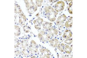 Immunohistochemistry of paraffin-embedded human stomach using ALKBH4 antibody at dilution of 1:100 (x40 lens).