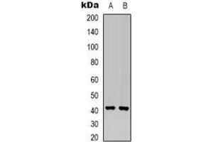Western blot analysis of MKK6 expression in Hela (A), HEK293T (B) whole cell lysates. (MAP2K6 Antikörper  (N-Term))