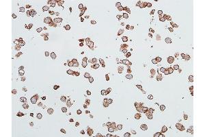 Immunocytochemistry (ICC) image for anti-Carcinoembryonic Antigen-Related Cell Adhesion Molecule 1 (CEACAM1) (AA 35-433) antibody (ABIN7455148) (Rekombinanter CEACAM1 Antikörper  (AA 35-433))