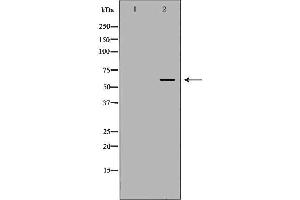 Western blot analysis of A549 cell lysate, using TBXAS1 Antibody.