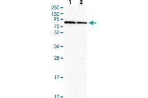 Western blot analysis of Lane 1: Human cell line RT-4 Lane 2: Human cell line U-251MG with RNF10 polyclonal antibody  at 1:250-1:500 dilution. (RNF10 Antikörper)