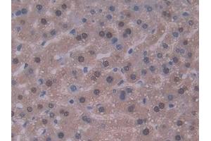 Detection of IL22 in Mouse Liver Tissue using Polyclonal Antibody to Interleukin 22 (IL22) (IL-22 Antikörper  (AA 34-179))