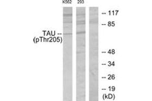 Western blot analysis of extracts from K562 cells and 293 cells, using Tau (Phospho-Thr205) Antibody. (tau Antikörper  (pThr522))