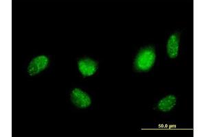 Immunofluorescence of purified MaxPab antibody to HNF4A on HeLa cell. (HNF4A Antikörper  (AA 1-464))