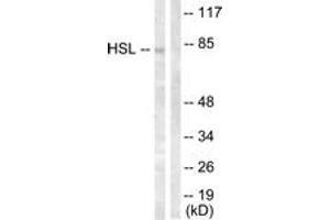 Western blot analysis of extracts from HeLa cells, treated with Calyculin A 100nM 30', using HSL (Ab-554) Antibody.