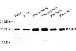 Western blot analysis of RAB21 (ABIN7075341) at dilution of 1: 500 (RAB21 Antikörper)