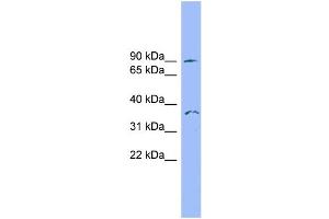 WB Suggested Anti-SDCCAG8 Antibody Titration: 0. (SDCCAG8 Antikörper  (N-Term))