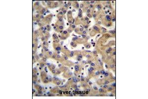 PDP1 Antibody (Center) (ABIN656386 and ABIN2845681) immunohistochemistry analysis in formalin fixed and paraffin embedded human liver tissue followed by peroxidase conjugation of the secondary antibody and DAB staining. (PDP Antikörper  (AA 308-336))