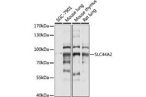 Western blot analysis of extracts of various cell lines, using SLC44 antibody (ABIN7270464) at 1:1000 dilution. (SLC44A2 Antikörper  (AA 150-250))