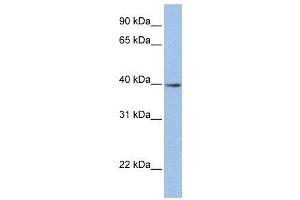 WB Suggested Anti-ZNF202  Antibody Titration: 0. (ZNF202 Antikörper  (N-Term))