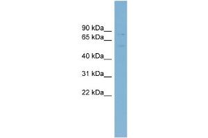 WB Suggested Anti-ABCG5 Antibody Titration: 0.
