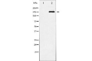 Western blot analysis of VEGFR2 phosphorylation expression in SK-OV3 whole cell lysates,The lane on the left is treated with the antigen-specific peptide. (VEGFR2/CD309 Antikörper  (pTyr951))