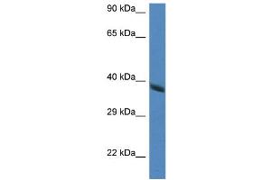 WB Suggested Anti-Hao2 Antibody   Titration: 1.