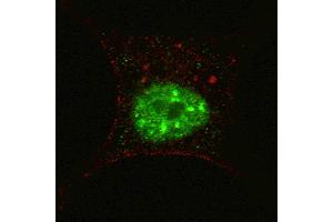 Fluorescent confocal image of SY5Y cells stained with phospho-STAT3- antibody. (STAT3 Antikörper  (pSer727))