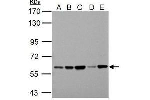 WB Image Sample (30 ug of whole cell lysate)    A: 293T   B: A431   C: HeLa   D: HepG2   E: A375   7. (Pyruvate Kinase Antikörper  (Center))