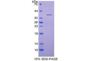 SDS-PAGE analysis of Human AQP1 Protein.
