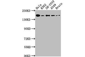 Western Blot Positive WB detected in: Hela whole cell lysate, K562 whole cell lysate, SH-SY5Y whole cell lysate, A549 whole cell lysate, Rat Brain whole cell lysate All lanes: APC antibody at 1:1000 Secondary Goat polyclonal to rabbit IgG at 1/50000 dilution Predicted band size: 312, 301, 309 kDa Observed band size: 160 kDa (Rekombinanter APC Antikörper)