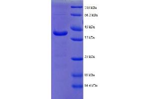 ATPC1 Protein (AA 43-161, partial) (GST tag)