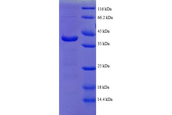 ATPC1 Protein (AA 43-161, partial) (GST tag)