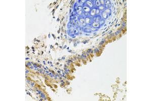 Immunohistochemistry of paraffin-embedded mouse lung using GP2 antibody (ABIN5975023) at dilution of 1/100 (40x lens). (GP2 Antikörper)