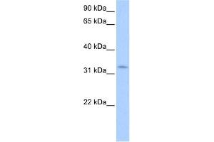 WB Suggested Anti-NRIP2 Antibody Titration:  0. (NRIP2 Antikörper  (N-Term))