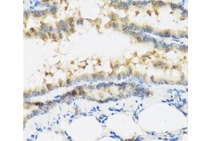Immunohistochemistry of paraffin-embedded Mouse lung using IFNL3 Polyclonal Antibody at dilution of 1:100 (40x lens). (IL28B Antikörper)