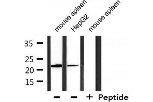 Western blot analysis of extracts from mouse spleen, HepG2, using DIRA1 Antibody. (DIRAS1 Antikörper  (C-Term))