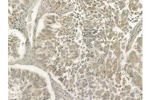 anti-Matrix Metallopeptidase 28 (MMP28) (Internal Region) antibody