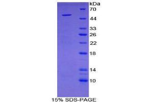 SDS-PAGE (SDS) image for Secretogranin II (SCG2) (AA 11-187) protein (His tag,GST tag) (ABIN2123587) (SCG2 Protein (AA 11-187) (His tag,GST tag))