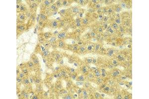 Immunohistochemistry of paraffin-embedded Rat liver using ADCK3 Polyclonal Antibody at dilution of 1:100 (40x lens). (COQ8A Antikörper)