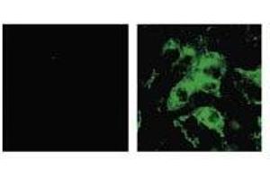 Immunofluorescence (IF) image for anti-SARS-Coronavirus Spike Protein (SARS-CoV S) antibody (ABIN2452119) (SARS-CoV Spike Antikörper)