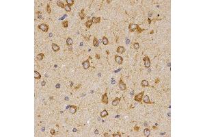 Immunohistochemistry of paraffin-embedded rat brain tissue using SCTR antibody at dilution of 1:200 (x400 lens) (SCTR Antikörper)