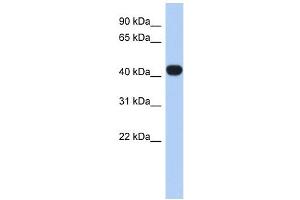RASGEF1C antibody used at 1 ug/ml to detect target protein. (RASGEF1C Antikörper  (N-Term))