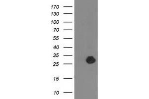 HEK293T cells were transfected with the pCMV6-ENTRY control (Left lane) or pCMV6-ENTRY ZFAND2B (Right lane) cDNA for 48 hrs and lysed. (ZFAND2B Antikörper)